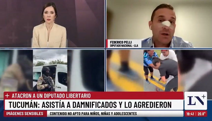 Pelli habló en LN+ tras el ataque en La Madrid: “Recuperándome de a poco”