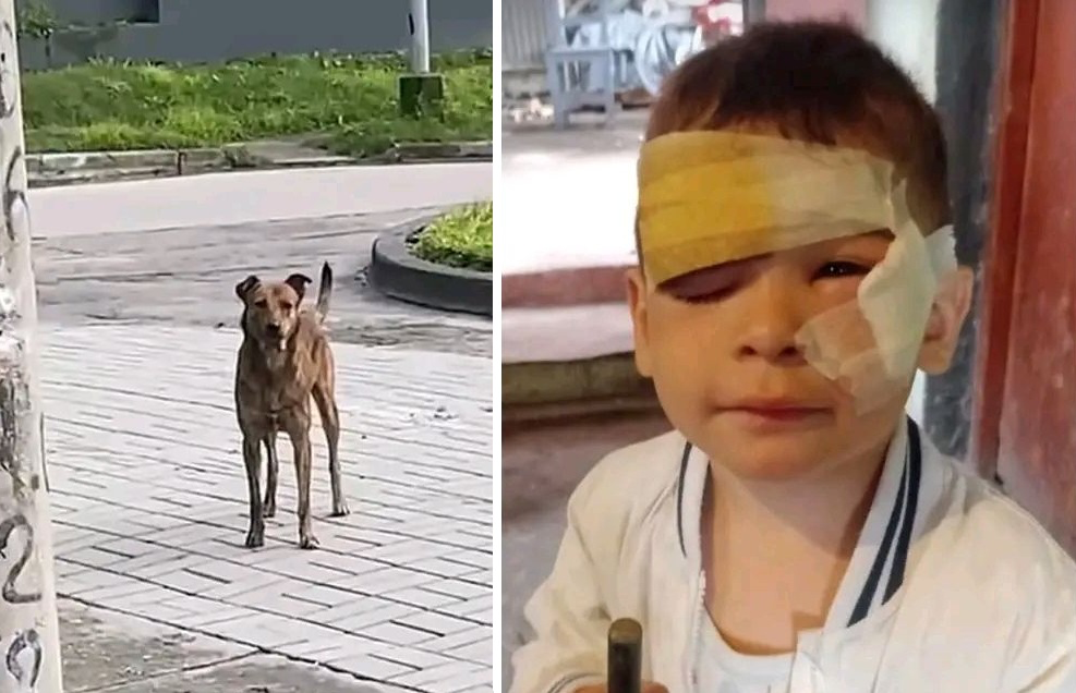 Un perro entró a una casa y atacó a un nene de 3 años en Concepción