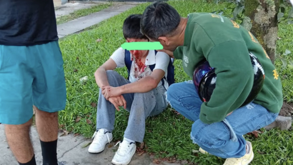 Bache provoca caída de un alumno en bicicleta camino a clases